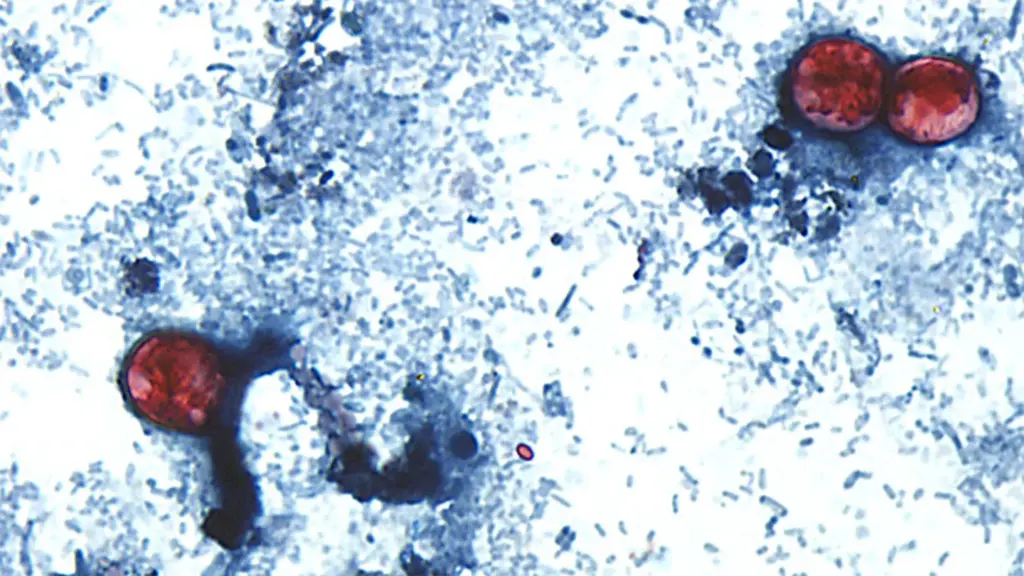 Kansas entre los estados afectados por brote de Cyclospora vinculado a lechuga contaminada